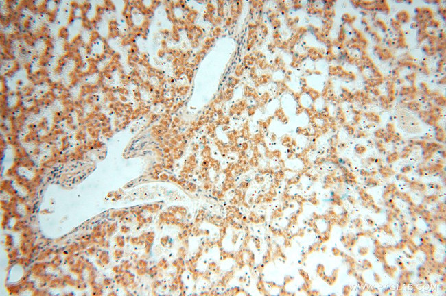 ACOT2 Antibody in Immunohistochemistry (Paraffin) (IHC (P))