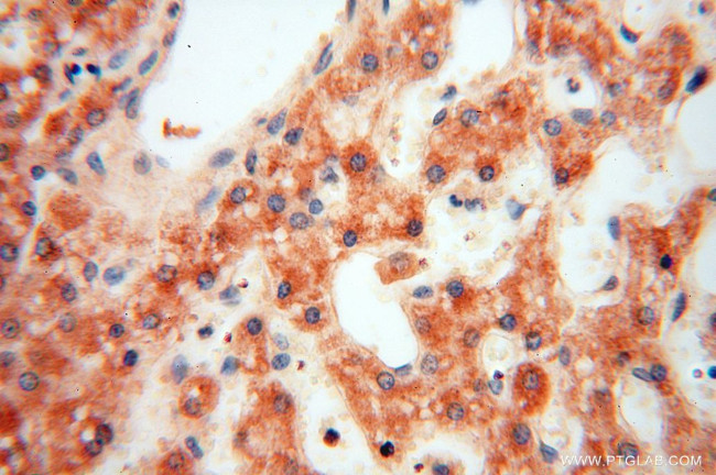 ACOT2 Antibody in Immunohistochemistry (Paraffin) (IHC (P))