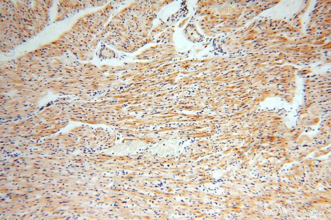 ACOT2 Antibody in Immunohistochemistry (Paraffin) (IHC (P))