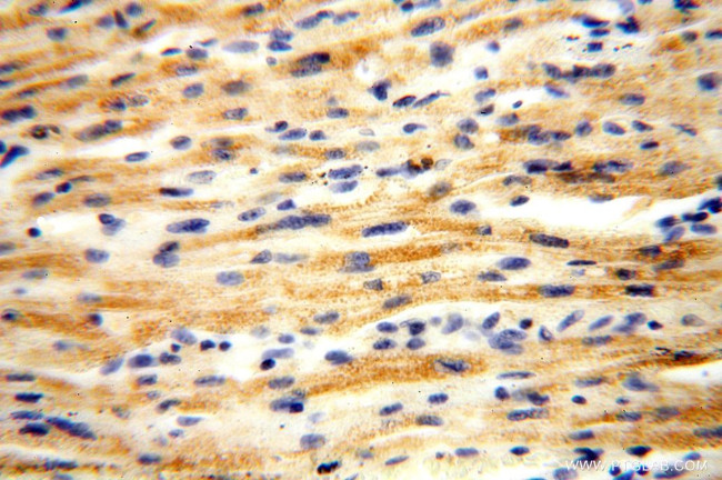 ACOT2 Antibody in Immunohistochemistry (Paraffin) (IHC (P))