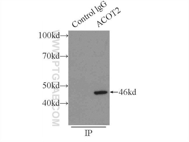 ACOT2 Antibody in Immunoprecipitation (IP)