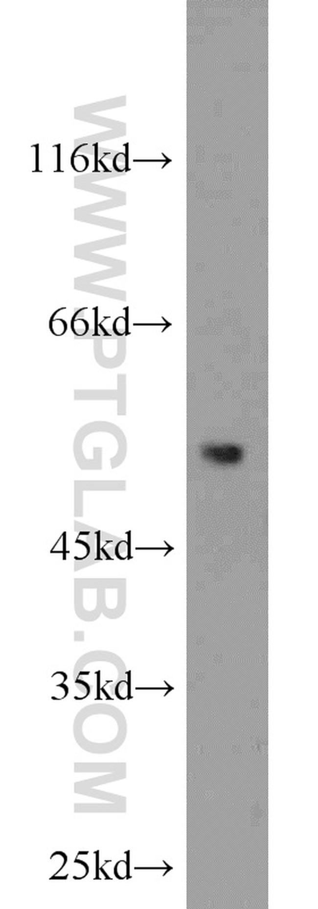 ACOT2 Antibody in Western Blot (WB)