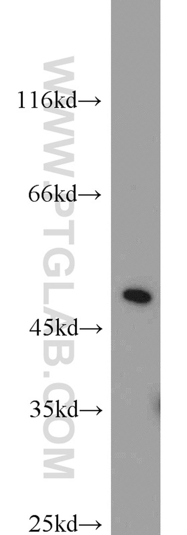 ACOT2 Antibody in Western Blot (WB)