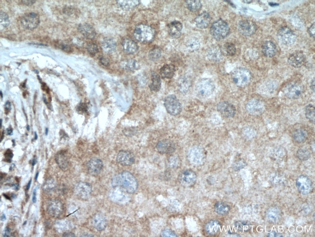 DUS3L Antibody in Immunohistochemistry (Paraffin) (IHC (P))