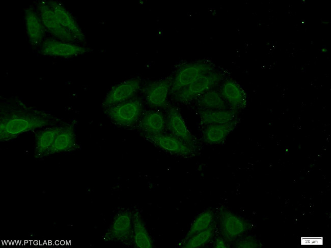 POM121 Antibody in Immunocytochemistry (ICC/IF)