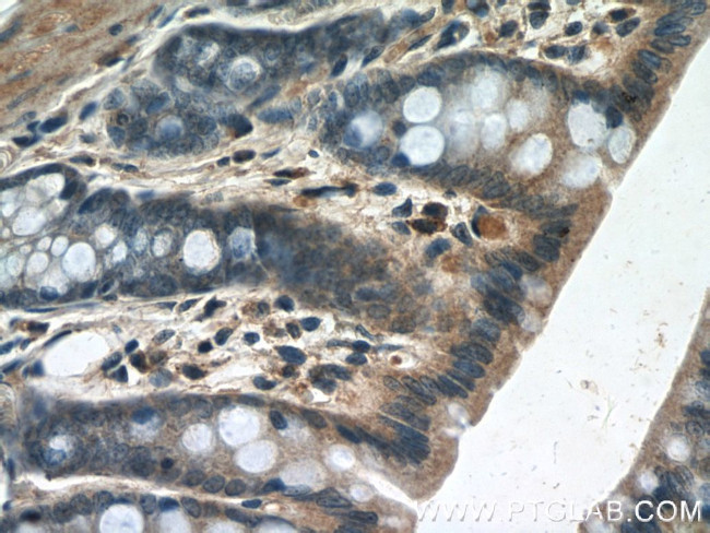 POM121 Antibody in Immunohistochemistry (Paraffin) (IHC (P))