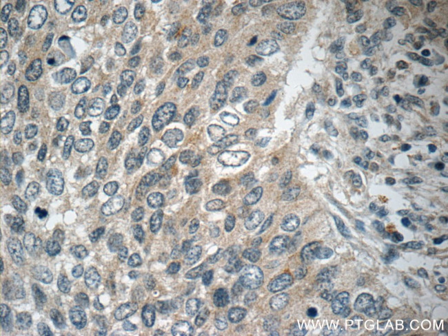 POM121 Antibody in Immunohistochemistry (Paraffin) (IHC (P))