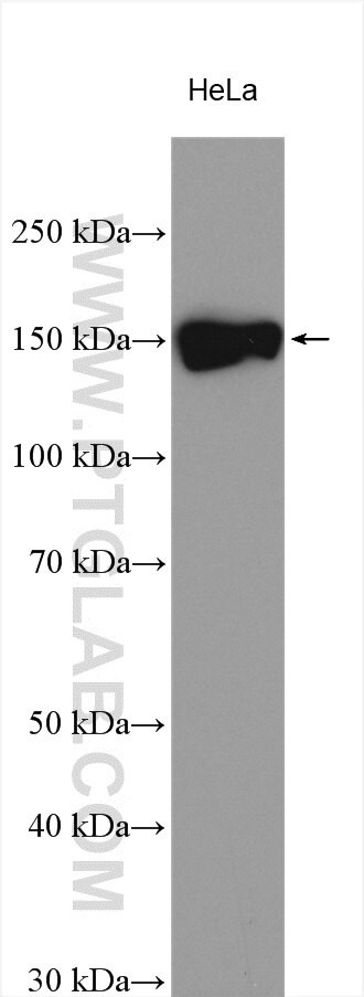 POM121 Antibody in Western Blot (WB)