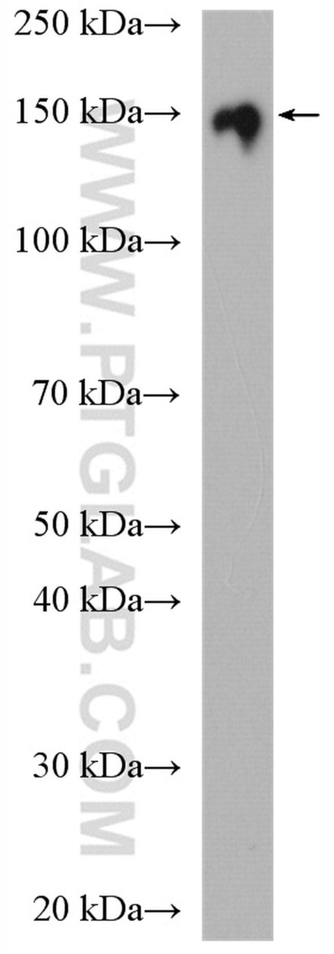 POM121 Antibody in Western Blot (WB)