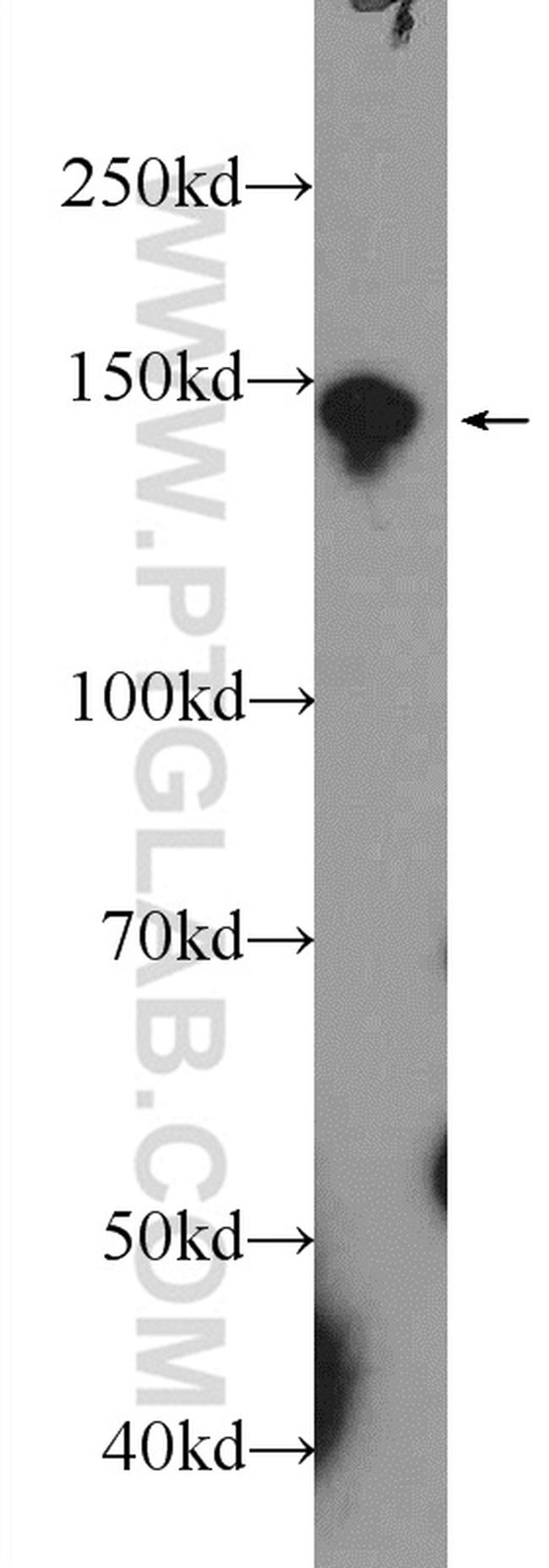 POM121 Antibody in Western Blot (WB)