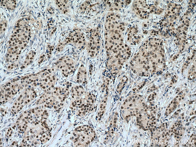 POLD1 Antibody in Immunohistochemistry (Paraffin) (IHC (P))