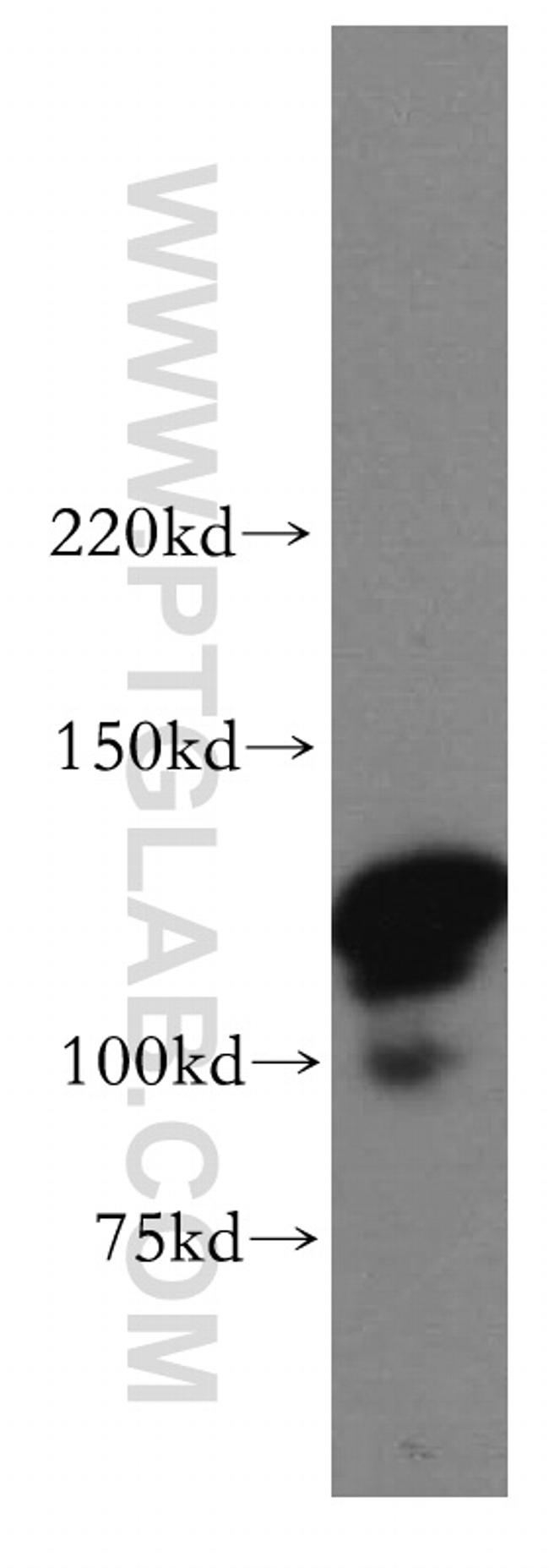 POLD1 Antibody in Western Blot (WB)