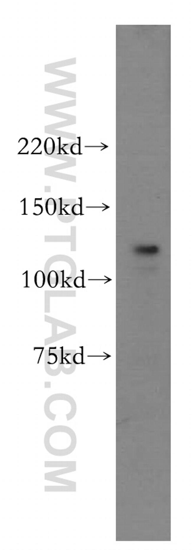 POLD1 Antibody in Western Blot (WB)