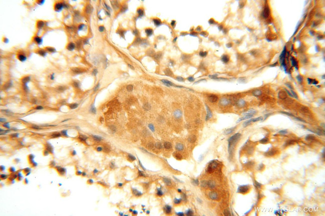 PDK2 Antibody in Immunohistochemistry (Paraffin) (IHC (P))