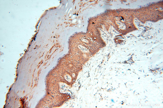 PDK2 Antibody in Immunohistochemistry (Paraffin) (IHC (P))