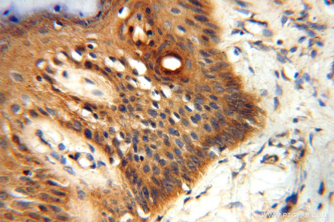 PDK2 Antibody in Immunohistochemistry (Paraffin) (IHC (P))