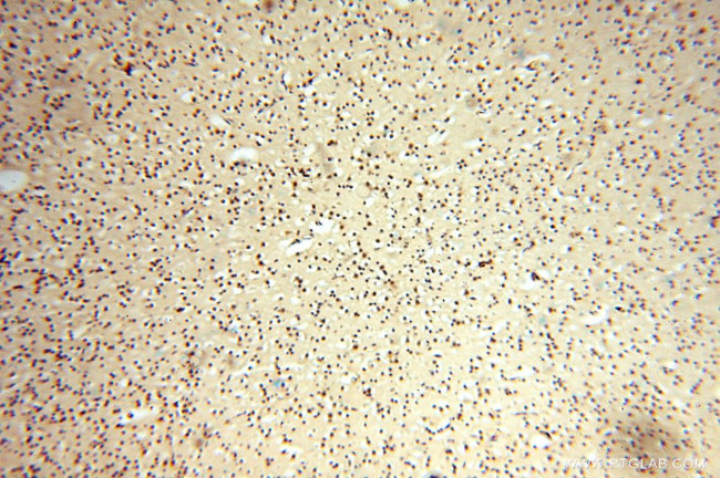 PDK2 Antibody in Immunohistochemistry (Paraffin) (IHC (P))