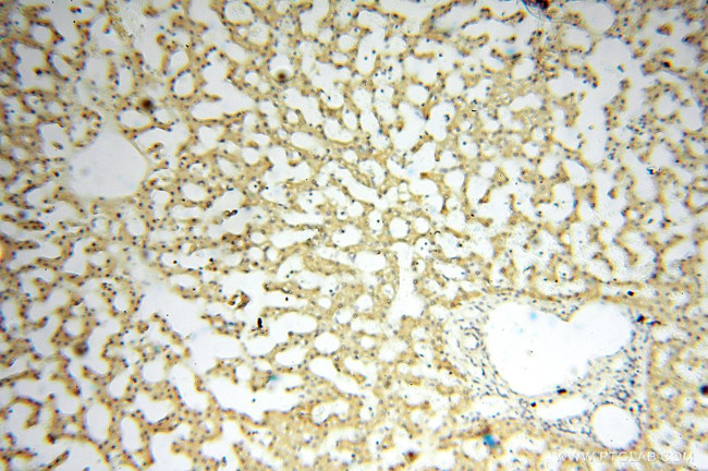 PDK2 Antibody in Immunohistochemistry (Paraffin) (IHC (P))