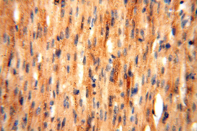 PDK2 Antibody in Immunohistochemistry (Paraffin) (IHC (P))