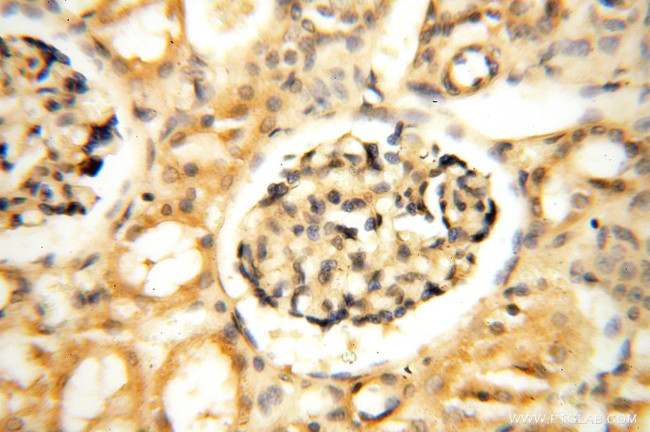 PDK2 Antibody in Immunohistochemistry (Paraffin) (IHC (P))