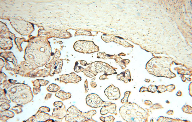 PDK2 Antibody in Immunohistochemistry (Paraffin) (IHC (P))