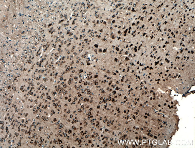 PDK2 Antibody in Immunohistochemistry (Paraffin) (IHC (P))