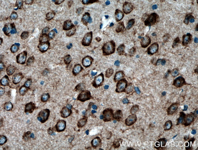 PDK2 Antibody in Immunohistochemistry (Paraffin) (IHC (P))