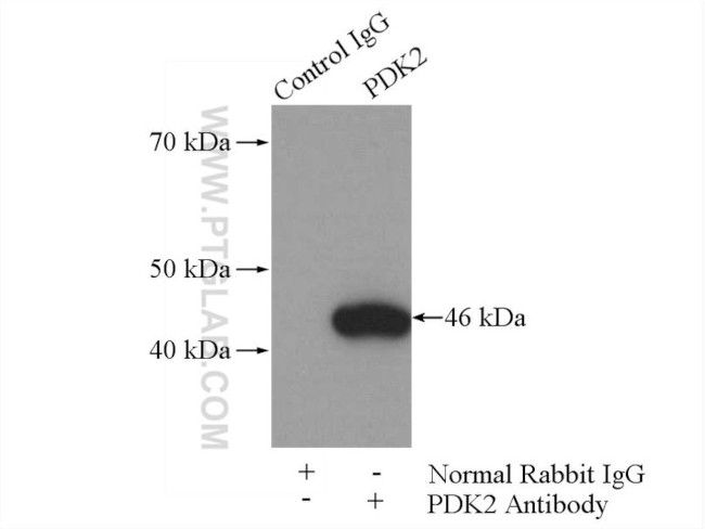 PDK2 Antibody in Immunoprecipitation (IP)