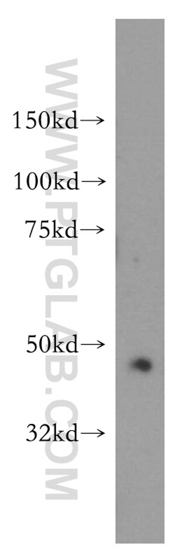 PDK2 Antibody in Western Blot (WB)