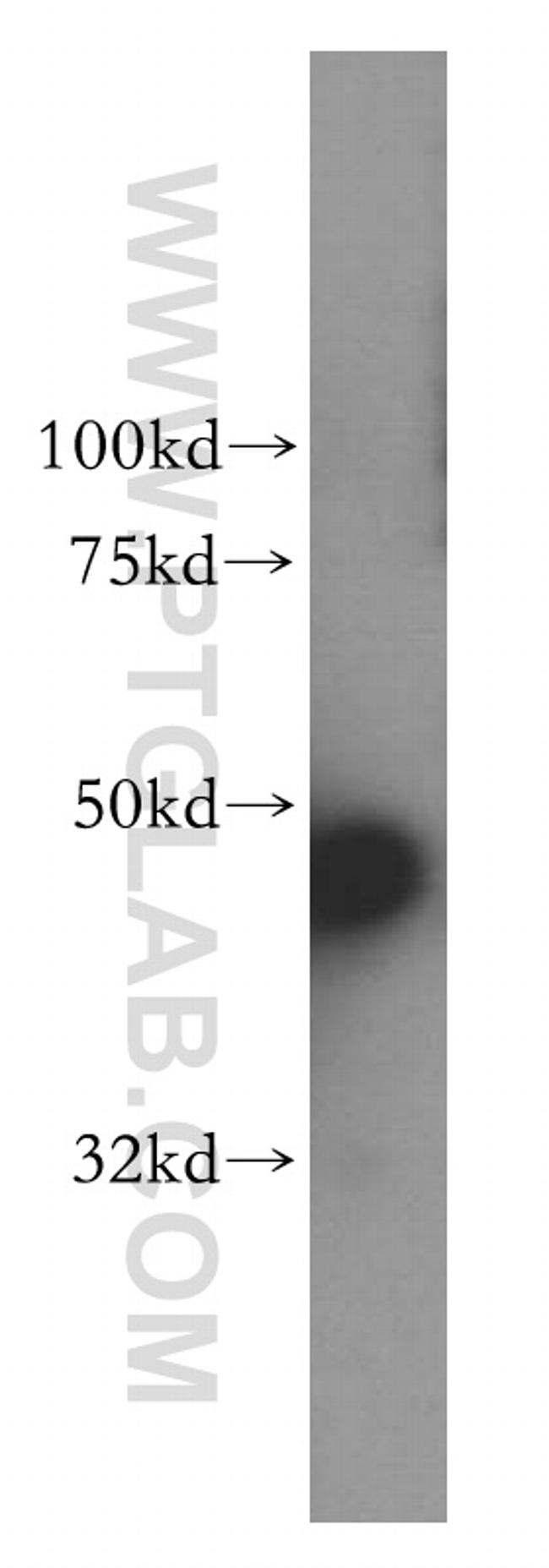 PDK2 Antibody in Western Blot (WB)