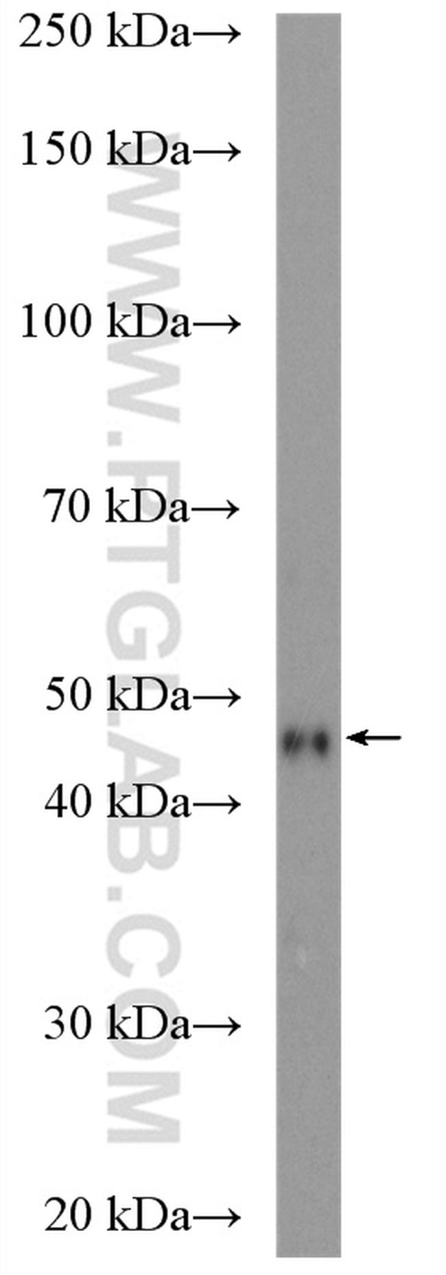 PDK2 Antibody in Western Blot (WB)