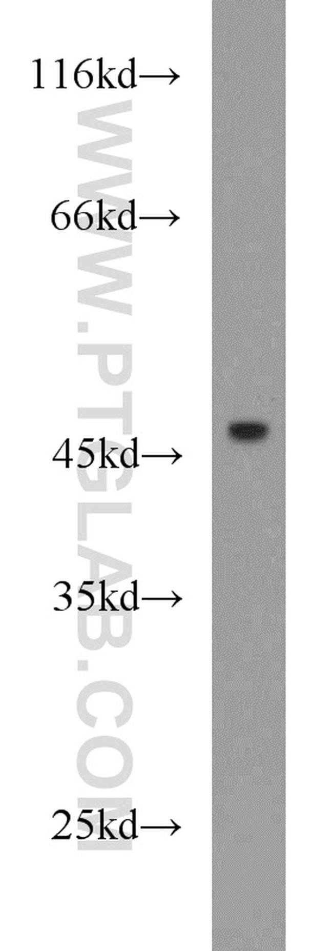 IL17RC Antibody in Western Blot (WB)