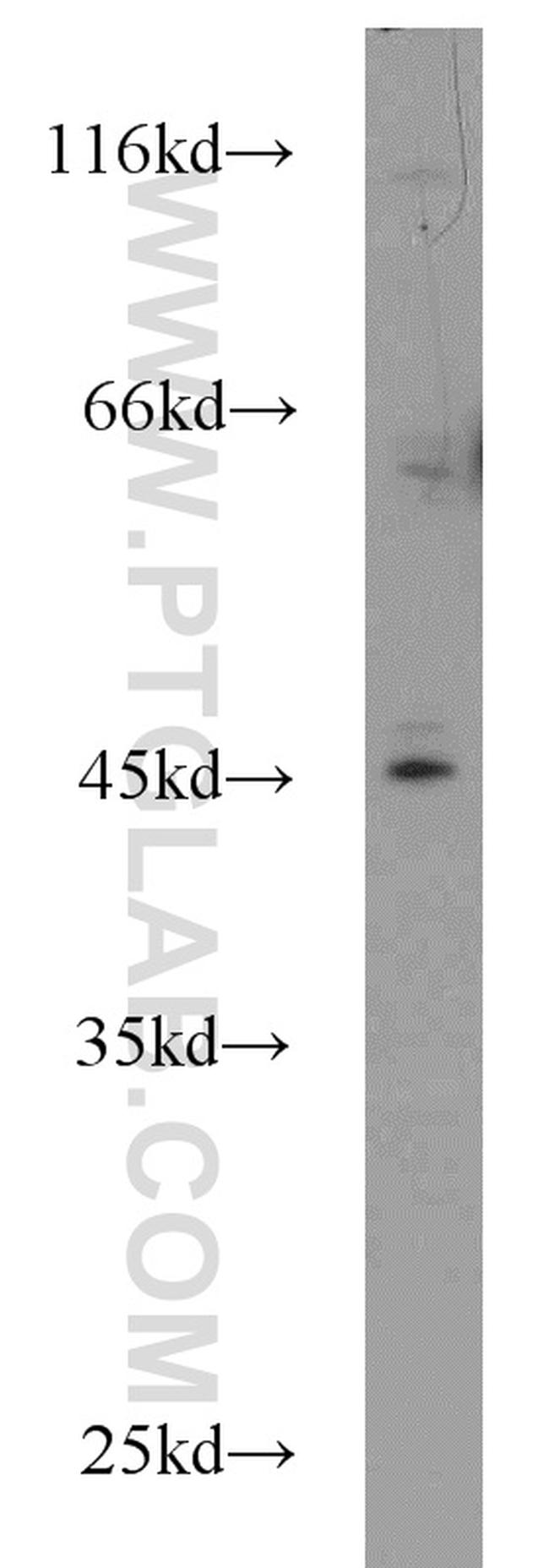 IL17RC Antibody in Western Blot (WB)