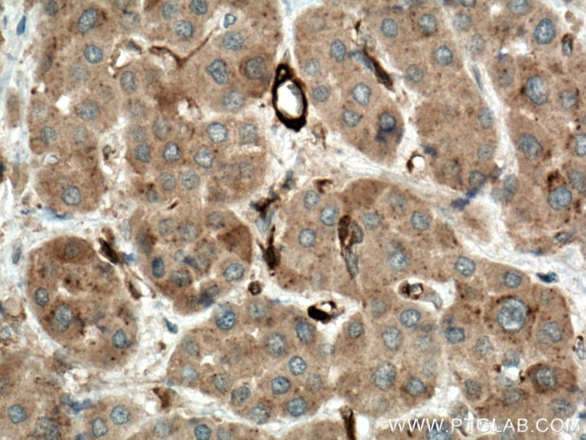 IKBKB Antibody in Immunohistochemistry (Paraffin) (IHC (P))