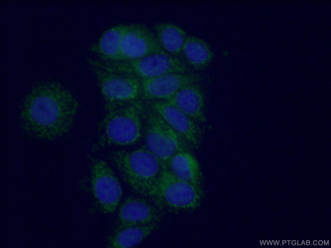 MTO1 Antibody in Immunocytochemistry (ICC/IF)