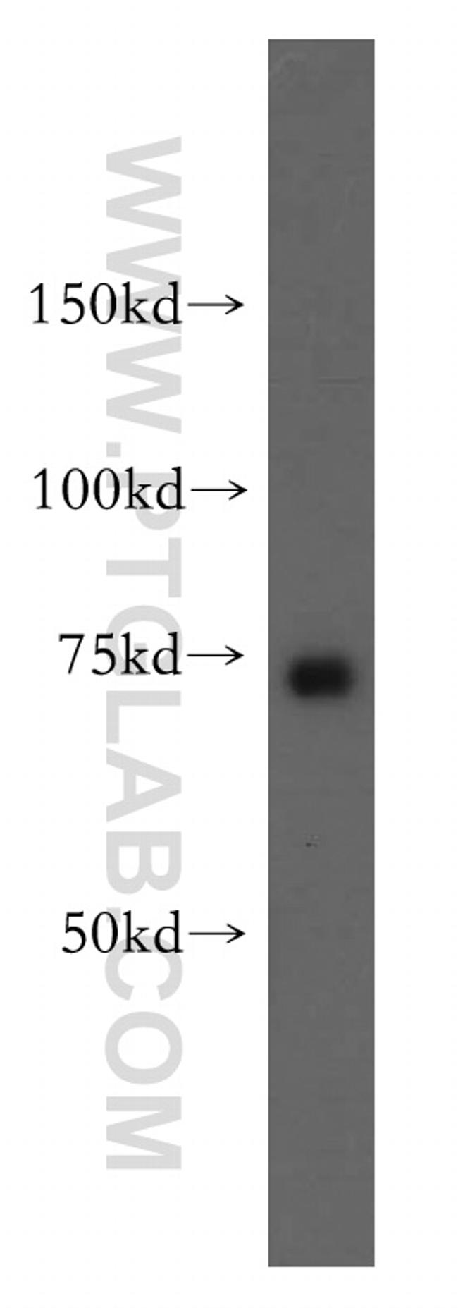 MTO1 Antibody in Western Blot (WB)