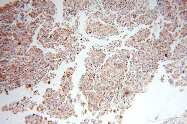 XPNPEP3 Antibody in Immunohistochemistry (Paraffin) (IHC (P))