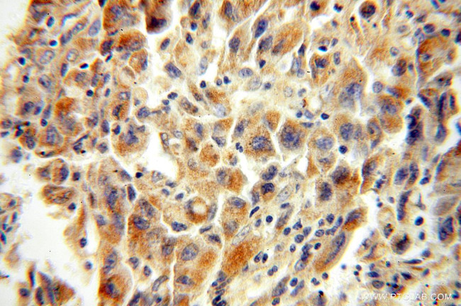 XPNPEP3 Antibody in Immunohistochemistry (Paraffin) (IHC (P))