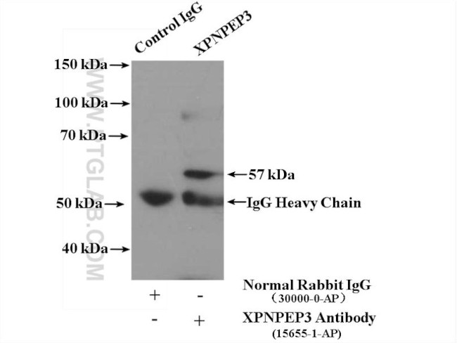 XPNPEP3 Antibody in Immunoprecipitation (IP)