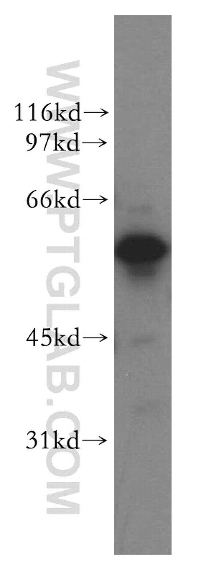 XPNPEP3 Antibody in Western Blot (WB)