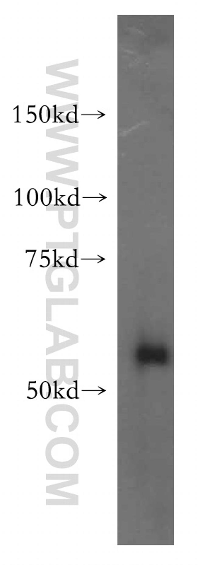 XPNPEP3 Antibody in Western Blot (WB)