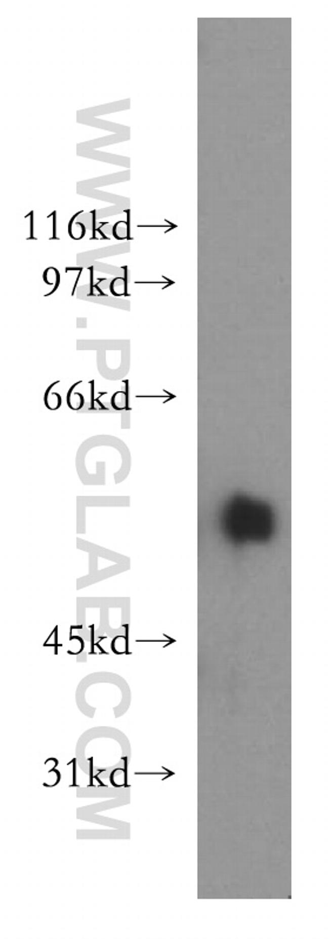 XPNPEP3 Antibody in Western Blot (WB)