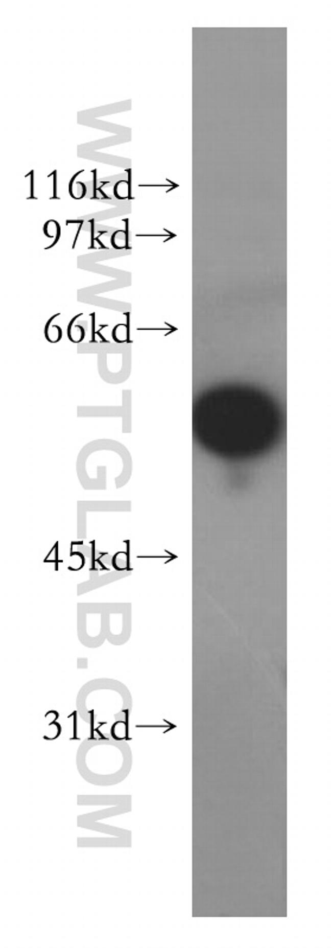 XPNPEP3 Antibody in Western Blot (WB)