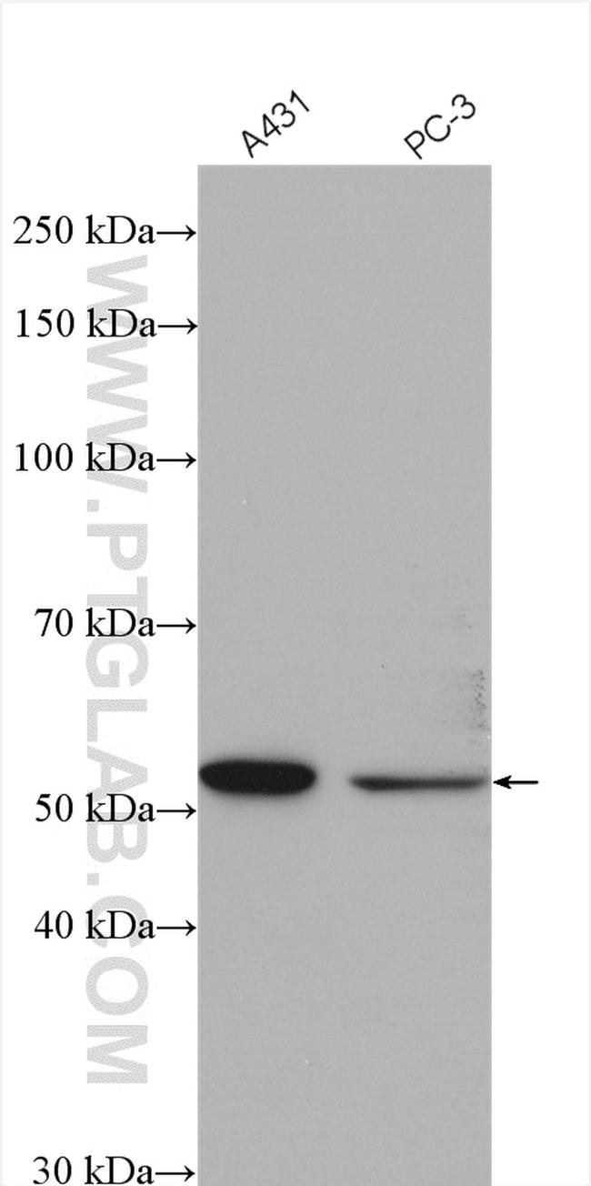 XPNPEP3 Antibody in Western Blot (WB)