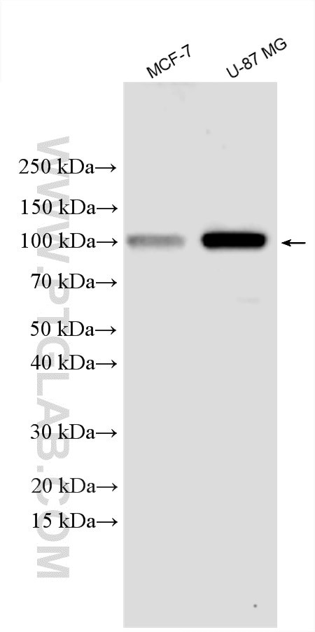 HK1 Antibody in Western Blot (WB)