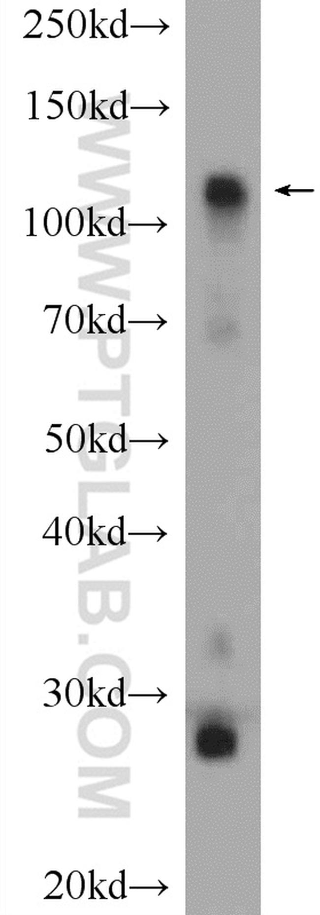 HK1 Antibody in Western Blot (WB)