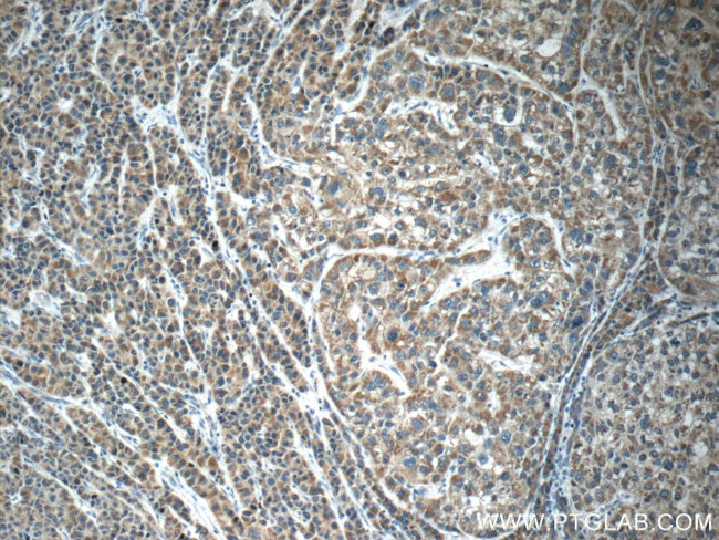 PIWIL1 Antibody in Immunohistochemistry (Paraffin) (IHC (P))