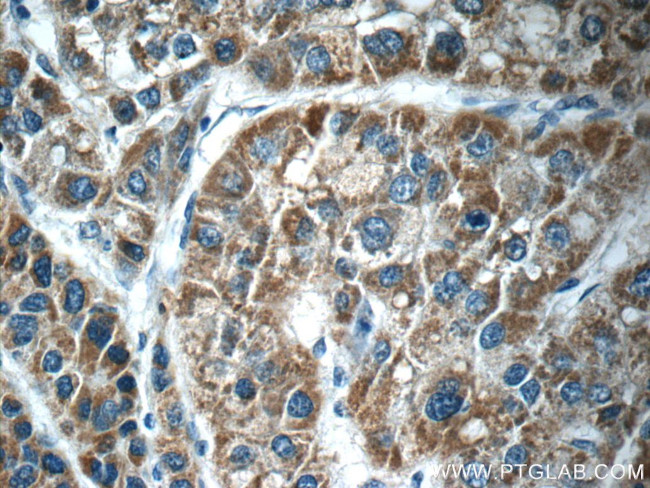 PIWIL1 Antibody in Immunohistochemistry (Paraffin) (IHC (P))