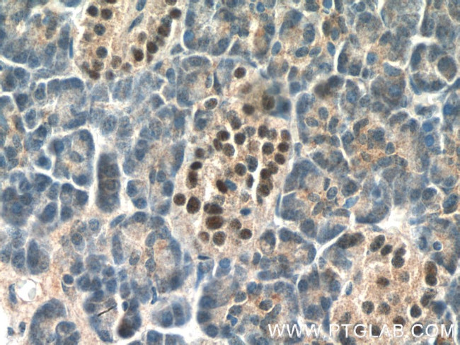 Islet 1 Antibody in Immunohistochemistry (Paraffin) (IHC (P))