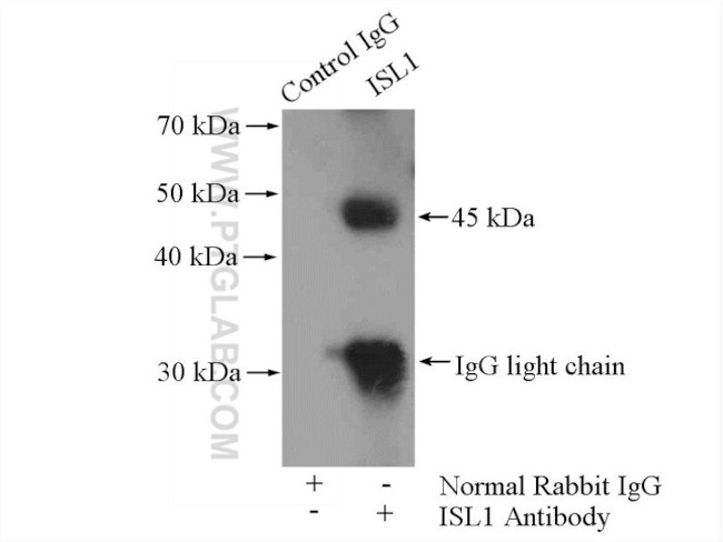 Islet 1 Antibody in Immunoprecipitation (IP)